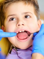 Kiedy usuwać zęby mleczne ze wskazań ortodontycznych?