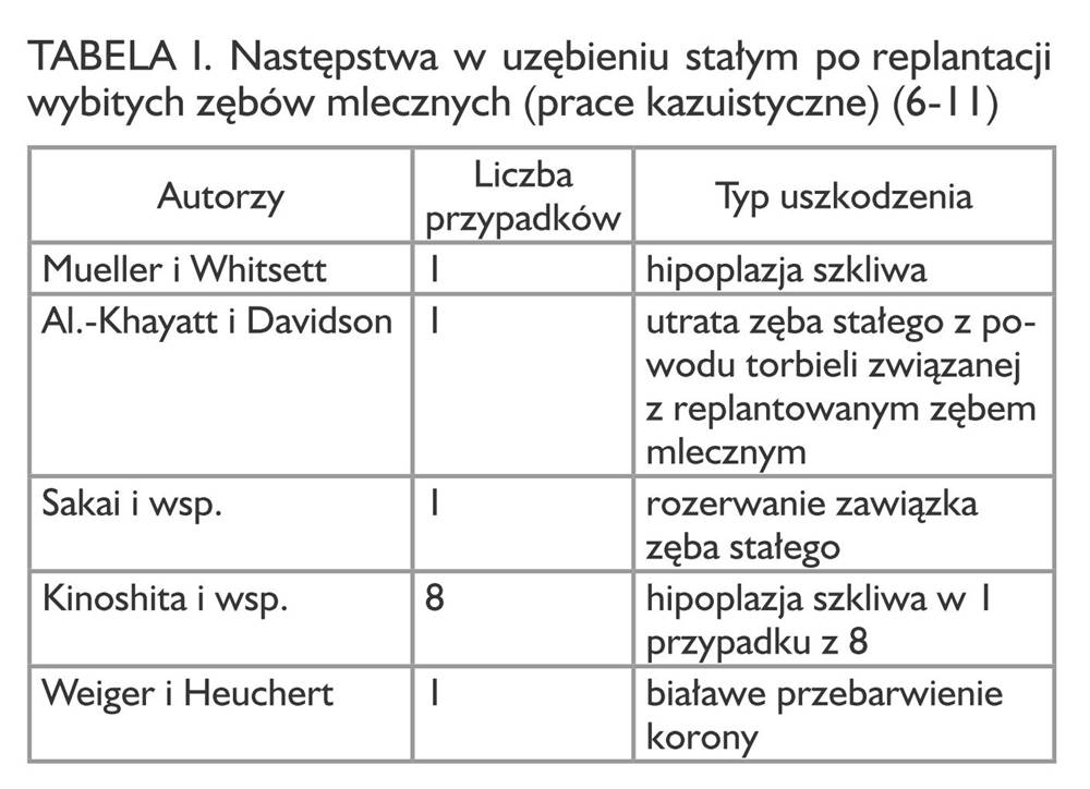 Jak postąpić w przypadku urazu zęba mlecznego (tab. I) Jak postąpić w przypadku urazu zęba mlecznego (tab. I)