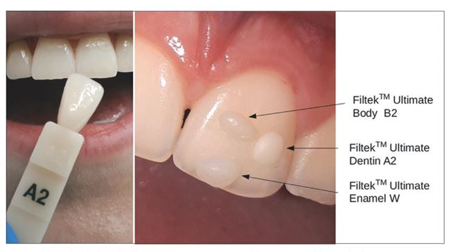 Dobór koloru ryc. 1