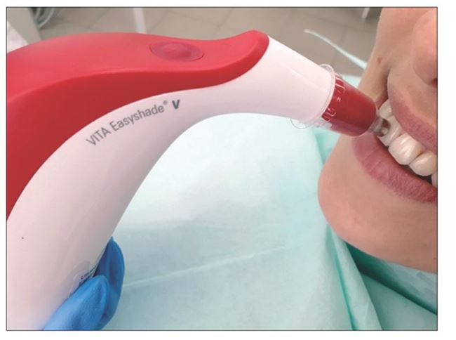 Dobór koloru ryc. 6