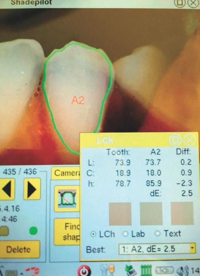 Dobór koloru ryc. 7