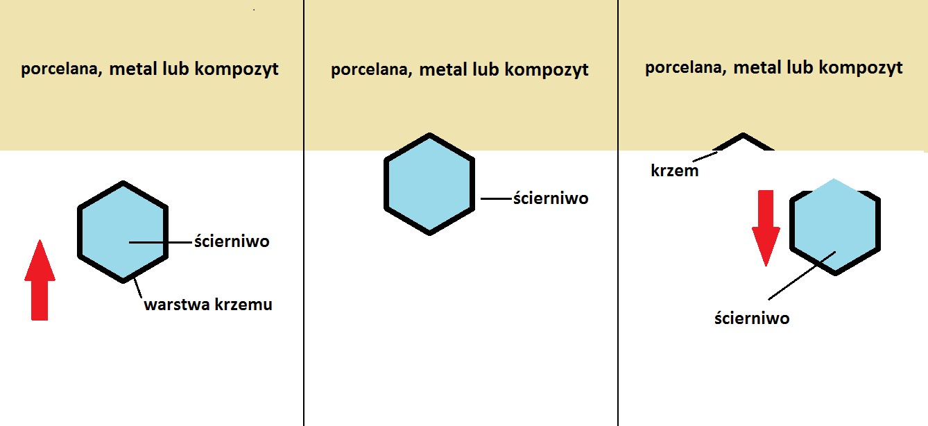 Specjalista radzi - licówki - ryc. 4