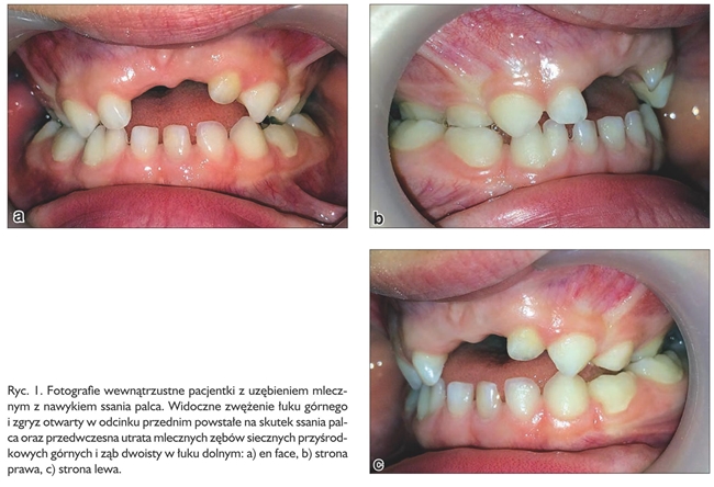 ortodoncja ryc 1