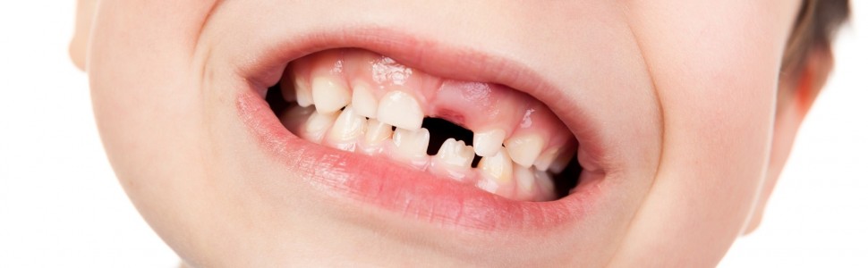 Zachowanie wzrostu wyrostka zębodołowego kości szczęki po złamaniu korzenia na wysokości szyjki zęba. Opis przypadku