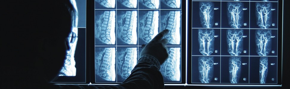  Pokonać raka – nadzieja w immunoterapii