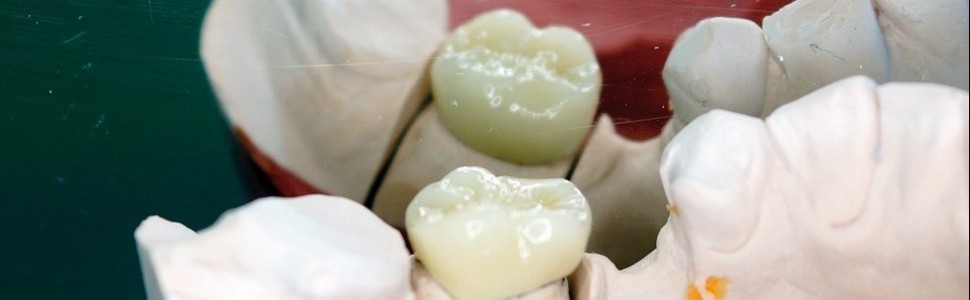Trudne sytuacje w endodoncji 