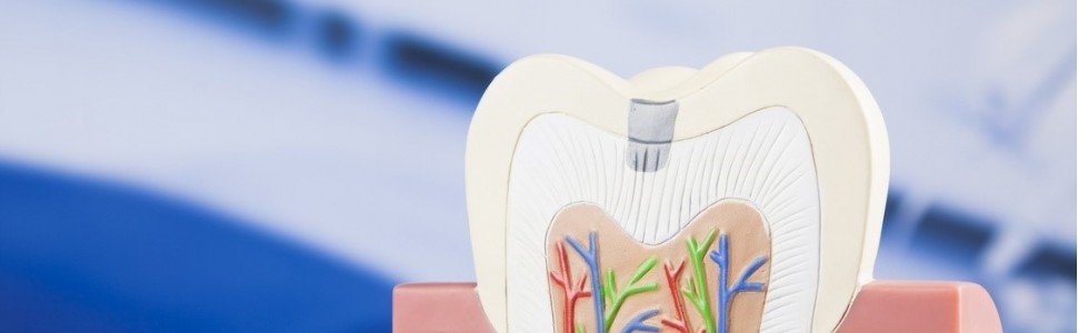 Czas uformowania się wierzchołka korzenia podczas apeksyfikacji wodorotlenkiem wapnia