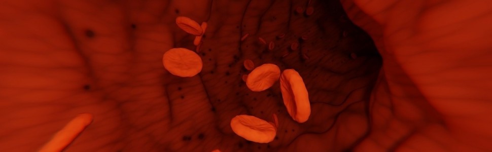 Zasady leczenia doustnymi lekami przeciwpłytkowymi. Postępowanie w przypadku planowych zabiegów operacyjnych