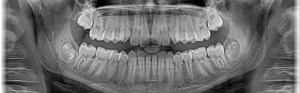Analiza umiejętności różnicowania obrazów radiologicznych zębów przez przyszłych lekarzy dentystów – badanie pilotażowe