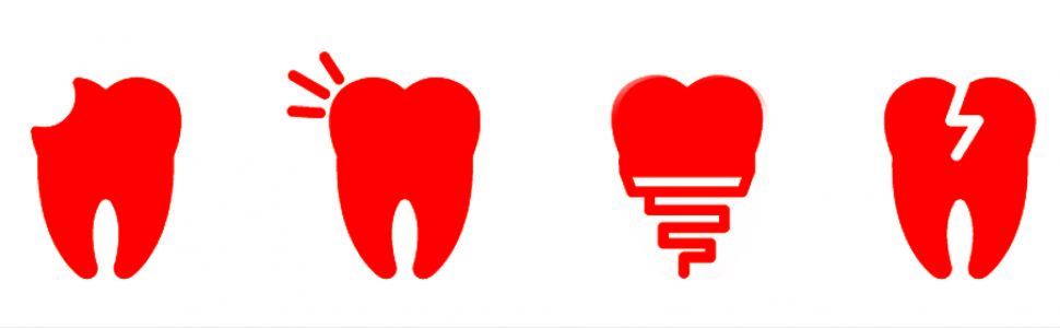 Wpływ próchnicy i odbudowy koronowej na stan zdrowia przyzębia wierzchołkowego w populacji regionu łódzkiego