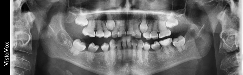 Diagnostyka obrazowa wrodzonego niedorozwoju szkliwa i wrodzonego niedorozwoju zębiny. Opis przypadków