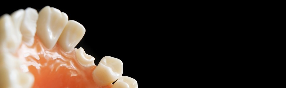 Częstość występowania i rodzaje urazów zębów stałych u pacjentów zgłaszających się do Katedry i Zakładu Stomatologii Wieku Rozwojowego Stomatologicznego Centrum Klinicznego Uniwersytetu  Medycznego w Lublinie w latach 2015‑2017