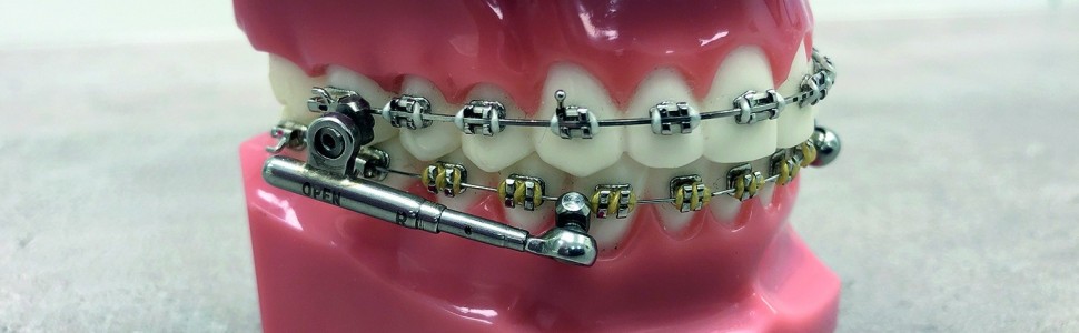 Zastosowanie aparatu PowerScope w leczeniu czynnościowym wad klasy II. Przegląd piśmiennictwa