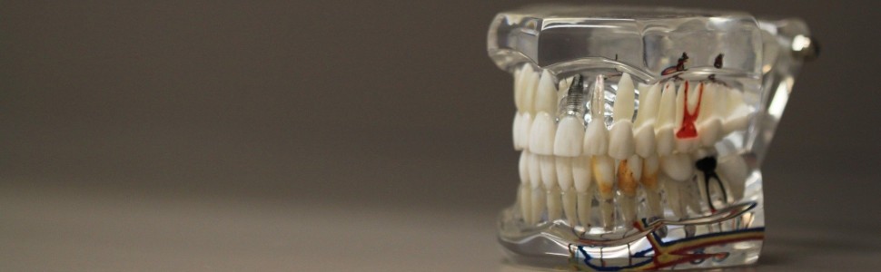 Zlokalizowane agresywne zapalenie przyzębia – opis przypadku