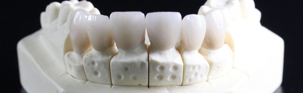 Jak uniknąć powikłań związanych z nieprawidłowościami podczas pobierania wycisków