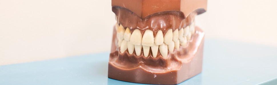 Naprawa pełnoceramicznej odbudowy zęba w odcinku przednim