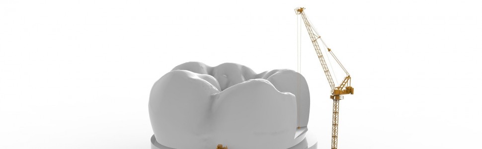 Kiedy podczas odbudowy korony zęba leczonego endodontycznie zastosować wkład kompozytowy wzmacniany włóknem szklanym?