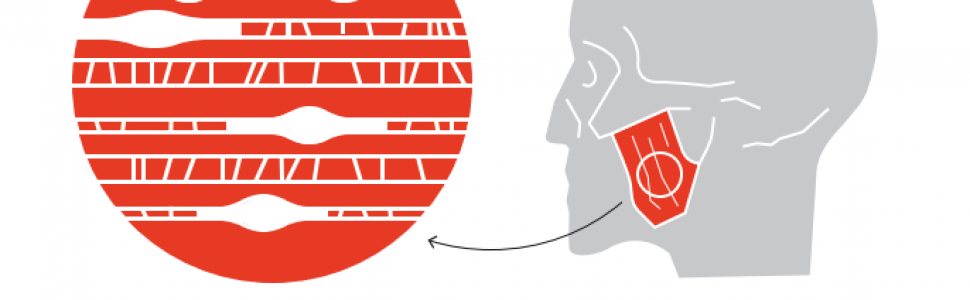 Zastosowanie elastografii ultrasonograficznej w diagnostyce i leczeniu bólu mięśniowo-powięziowego w obrębie mięśni układu stomatognatycznego. Przegląd piśmiennictwa