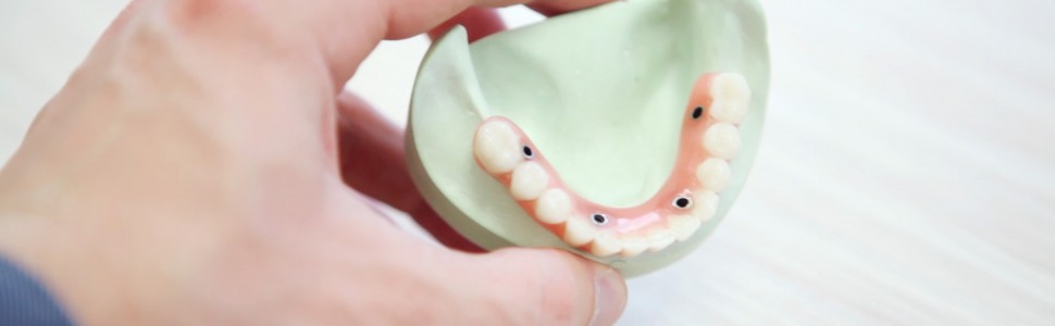 Leczenie protetyczne z zastosowaniem licówek na podstawie piśmiennictwa