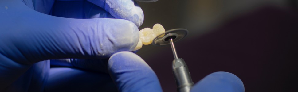 Atrycja – aktualny problem kliniczny na podstawie piśmiennictwa 