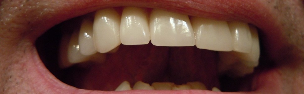 SPECJALISTA RADZI: Uszkodzenie przyczepu nabłonkowego podczas retrakcji dziąsła