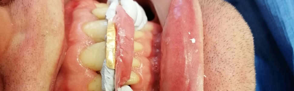 Szyna zwarciowa – metoda wykonania. Opis przypadku