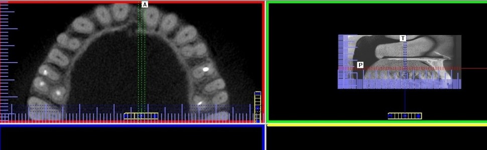 Endodoncja czy implantologia?