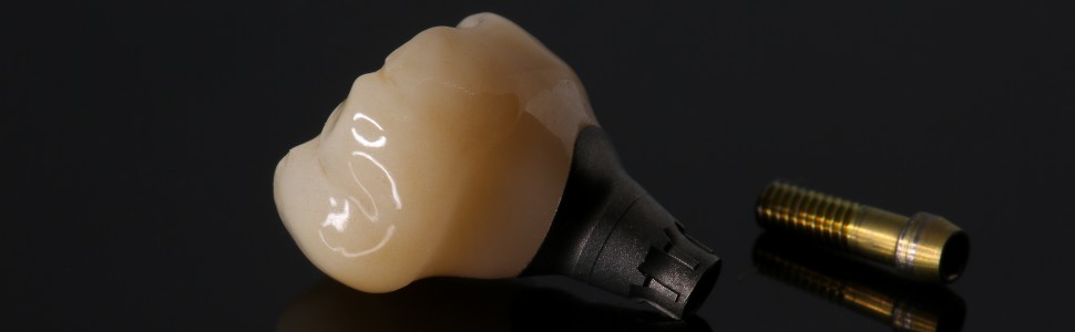 Implantacja natychmiastowa kluczem do zachowania (...)