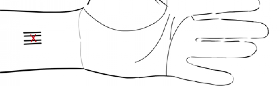 Sposoby zapobiegania odruchowi gardłowemu (...)