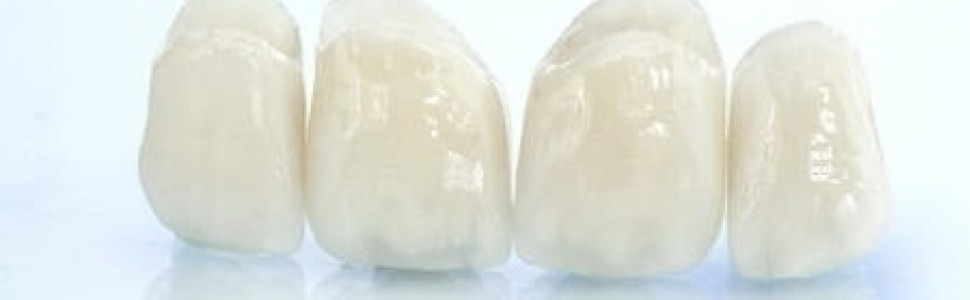 Uszkodzenia ceramiki licującej uzupełnień na podbudowie z tlenku cyrkonu (...)