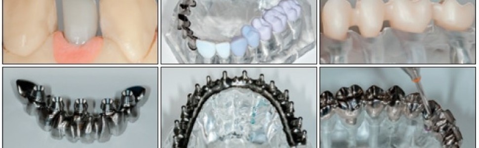 Cyfrowa droga w implantologii stomatologicznej