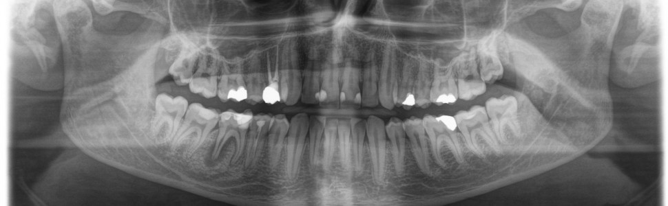 Codzienne przypadki krakowskiego endomaniaka (...)