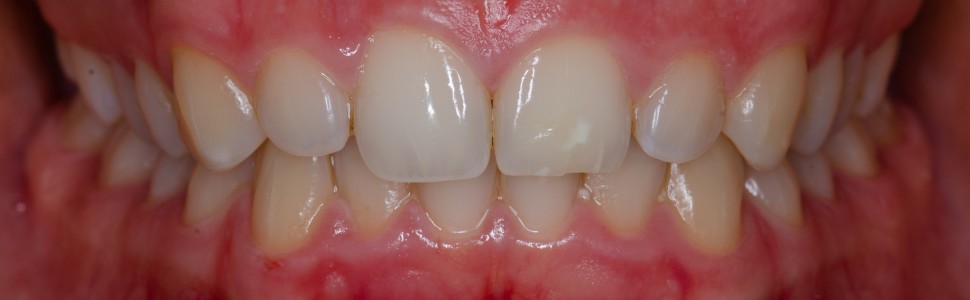 Część 5. Wpływ trójkąta ekspozycji na dokumentację fotograficzną 