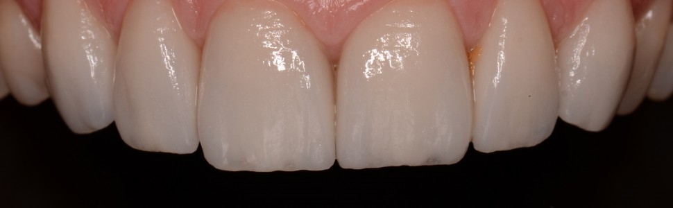 Postprodukcja w fotografii stomatologicznej
