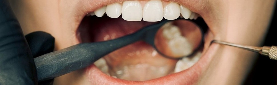 20 marca obchodzimy Światowy Dzień Zdrowia Jamy Ustnej  