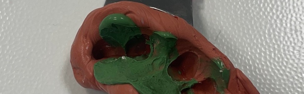 Najczęstsze błędy popełniane podczas wykonywania wycisków