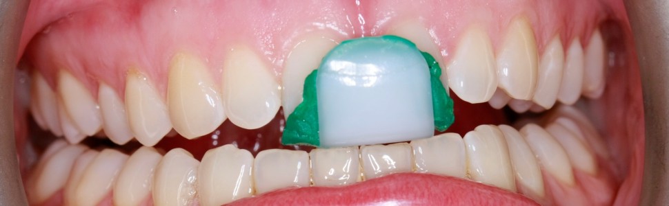 Wybrane metody deprogramacji nerwowomięśniowej w świetle współczesnej literatury oraz doświadczeń  własnych