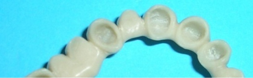 SPECJALISTA RADZI: Ochrona koroną tymczasową oszlifowanego zęba bezmiazgowego