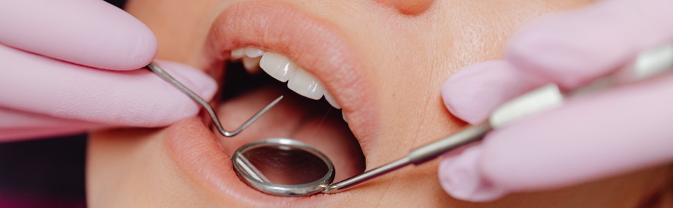 Skuteczność 8% argininy w leczeniu nadwrażliwości zębiny