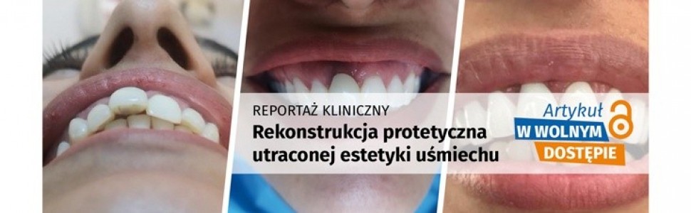 Przeczytaj artykuł w wolnym dostępie!