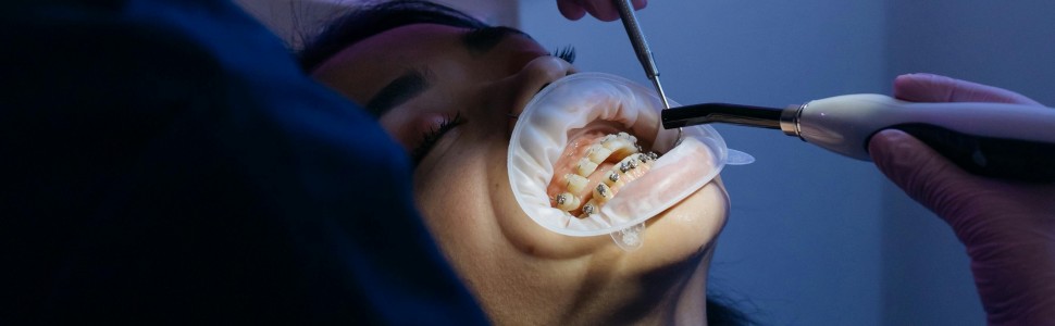 SPECJALISTA RADZI: Leczenie endodontyczne a ortodoncja