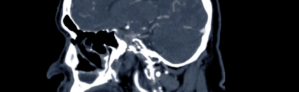 Tomografia stożkowa w obrazowaniu stawów skroniowo-żuchwowych – Ingrid Różyło-Kalinowska