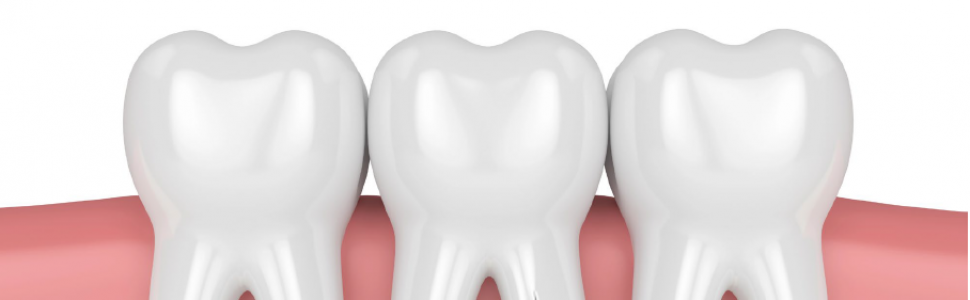 Opis przypadku innowacyjnej metody leczenia chirurgicznego pionowych złamań korzeni zębów bocznych w 24-miesięcznej obserwacji