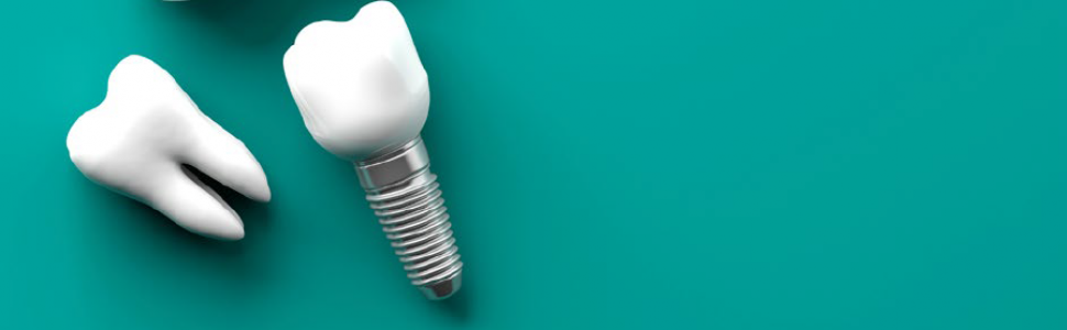 Leczenie powikłań estetycznych spowodowanych nieprawidłową pozycją implantu