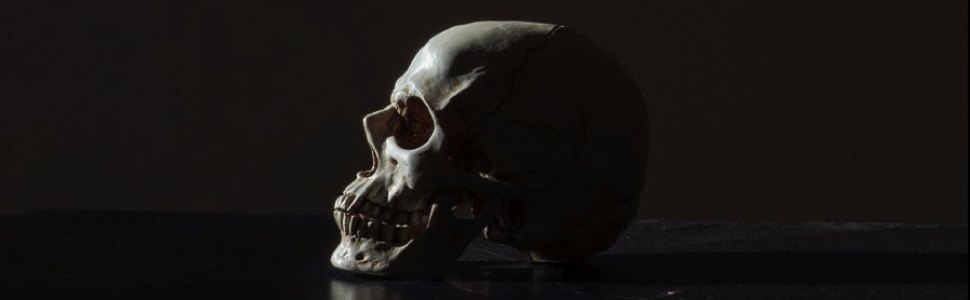 ARTYKUŁ ORYGINALNY. Osteosynteza w leczeniu złamań szczeki typu Le Fort I, II, III 