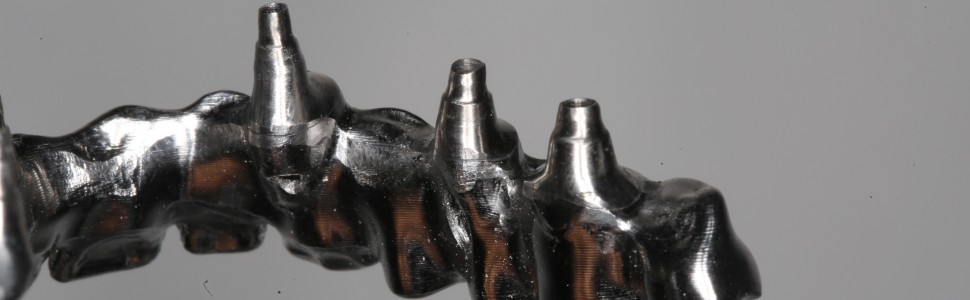 ARTYKUŁ PRZEGLĄDOWY. Cementowane i przykręcane konstrukcje implantoprotetyczne - strategie wyboru rodzaju umocowania do wszczepów na podstawie przeglądu piśmiennictwa