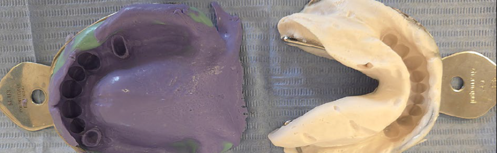 OPIS PRZYPADKU. Leczenie protetyczne z zastosowaniem protez szkieletowych klamrowych i bezklamrowych