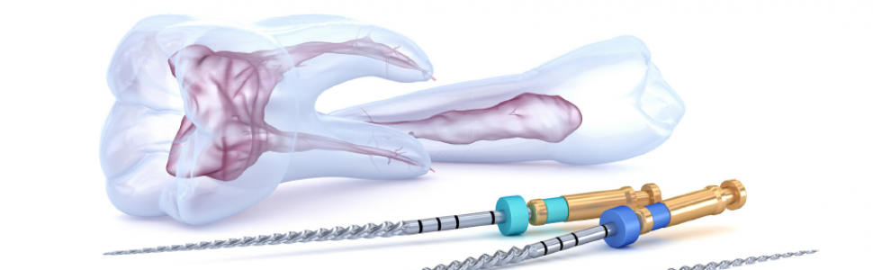 PROCEDURA. Odbudowa zębów leczonych endodontycznie