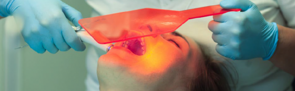 ARTYKUŁ PRZEGLĄDOWY. Lasery stosowane w leczeniu endodontycznym