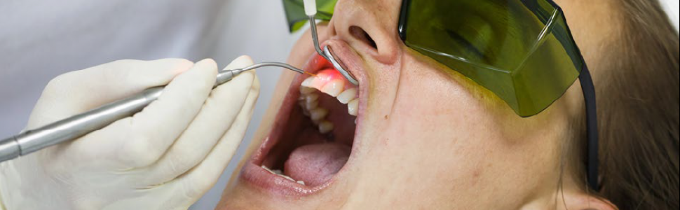 OPIS PRZYPADKU. Zastosowanie lasera CO2 w leczeniu leukopatii